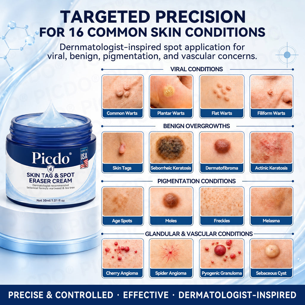 𝐏𝐢𝐜𝐝𝐨® 7-𝐃𝐚𝐲 𝐒𝐤𝐢𝐧 𝐓𝐚𝐠 & 𝐒𝐩𝐨𝐭 𝐄𝐫𝐚𝐬𝐞𝐫 𝐂𝐫𝐞𝐚𝐦🩵(Zero Pain, Zero 𝐒𝐜𝐚𝐫𝐬 Formula)🚀