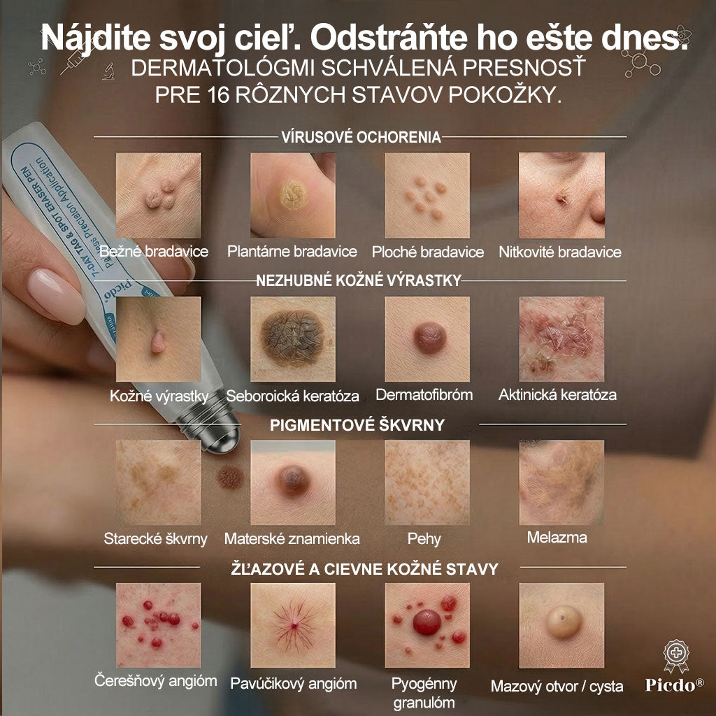 𝐎𝐟𝐢𝐜𝐢𝐚𝐥𝐧𝐲 𝐨𝐛𝐜𝐡𝐨𝐝 𝐦𝐚𝐫𝐤𝐲 | ✅️👩‍⚕️𝐏i𝐜𝐝o® 7dni Prípravok na odstránenie kožných výrastkov a pigmentových škvŕn (bezbolestný roll-on aplikátor bez jaziev) ❤️